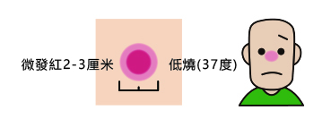 免疫細胞療法 (APM) Public 32 b